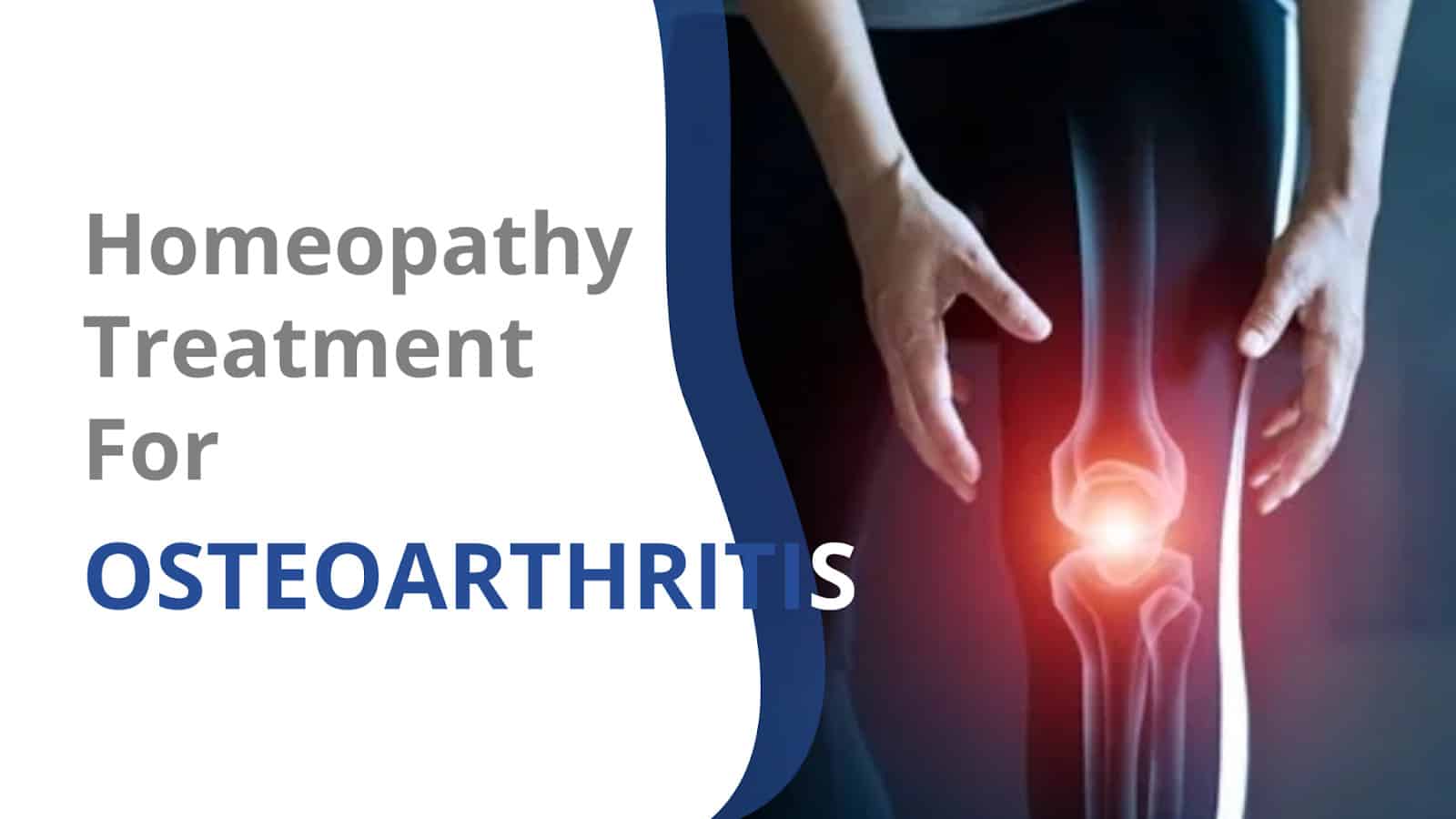 Read more about the article Homeopathy Treatment for Osteoarthritis
